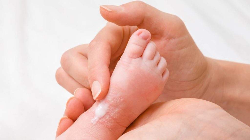 اگزما نیز یکی دیگر از بیماری های پوستی شایع است