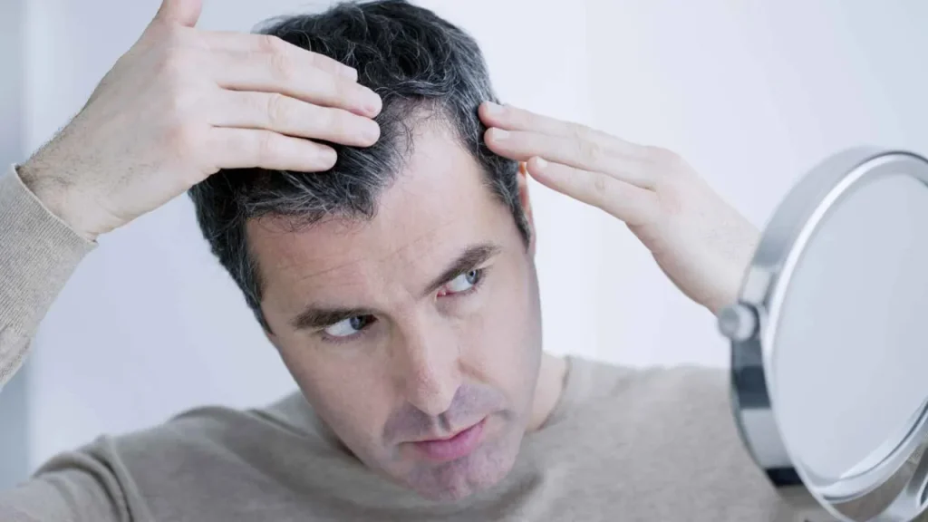 ریزش مو یکی از عوارض کم خوابی