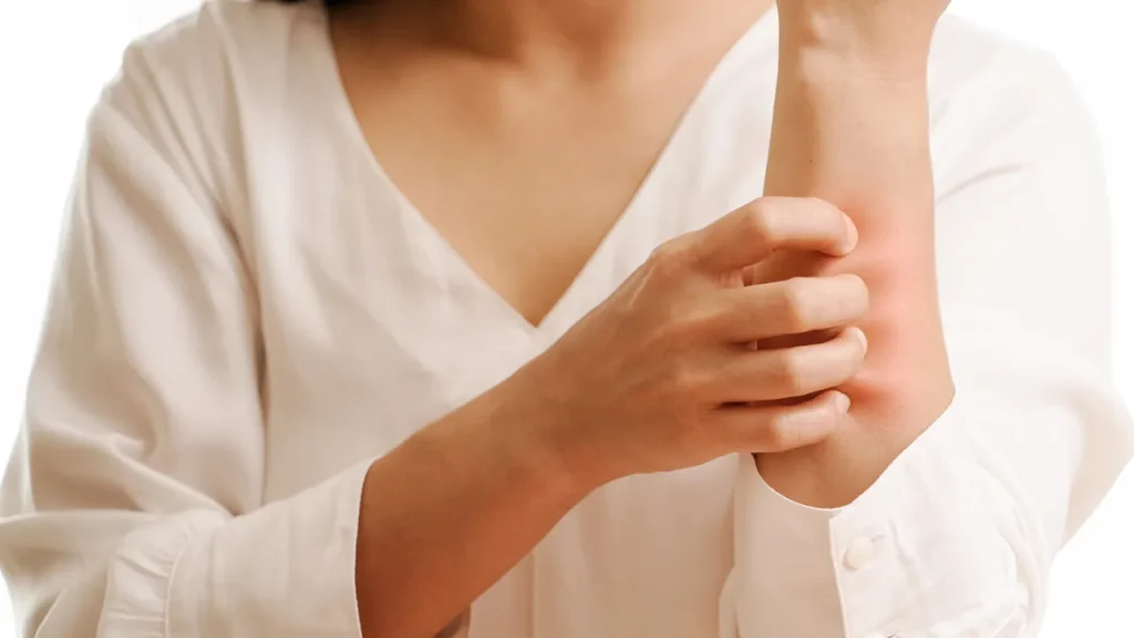 سوزش و احساس گزگز در پوست