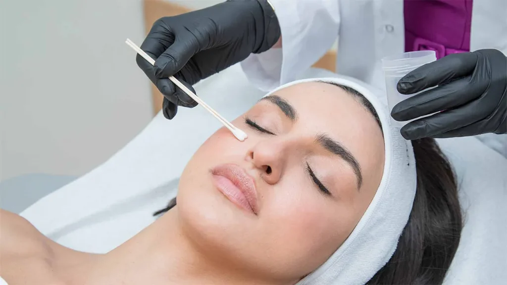 مزایای پیلینگ شیمیایی