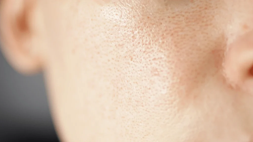 بهبود بافت پوست