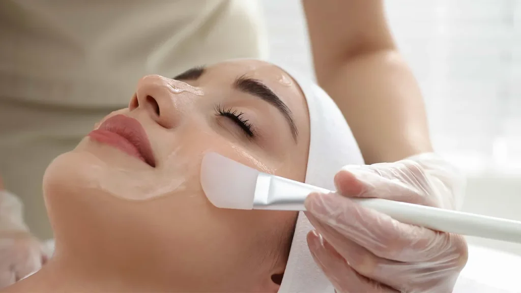 لایه برداری شیمیایی