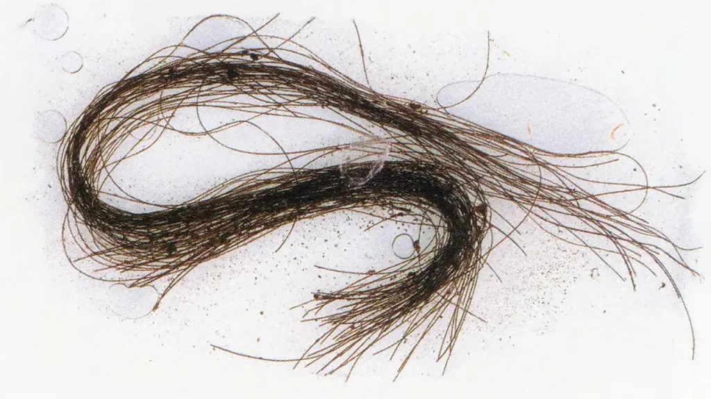 موخوره گره ای